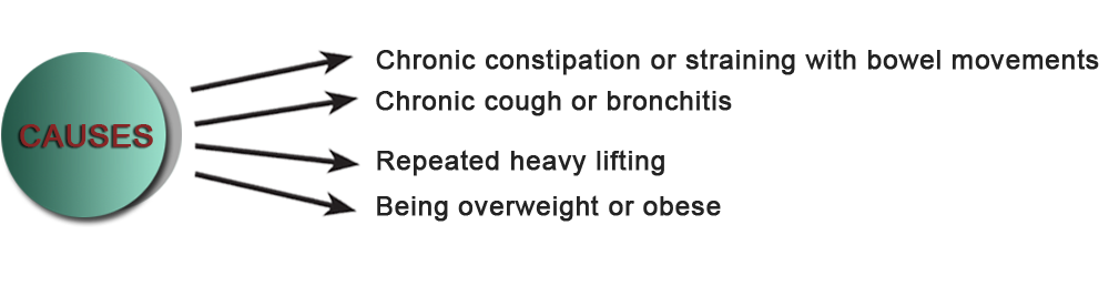 Causes Of Pelvic Organ Prolapse