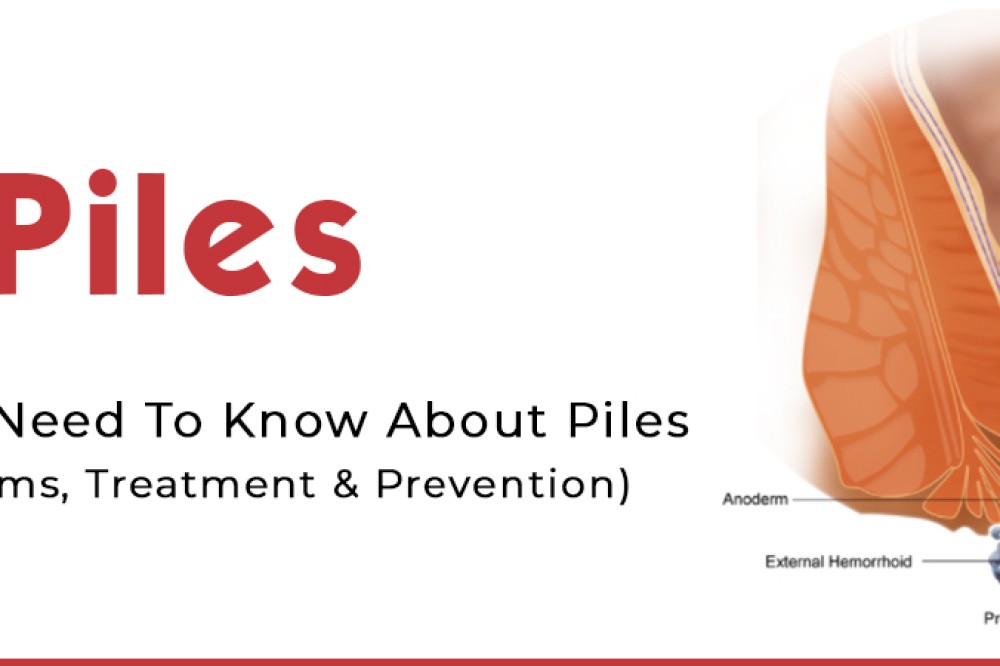 Everything You Need To Know About : Piles